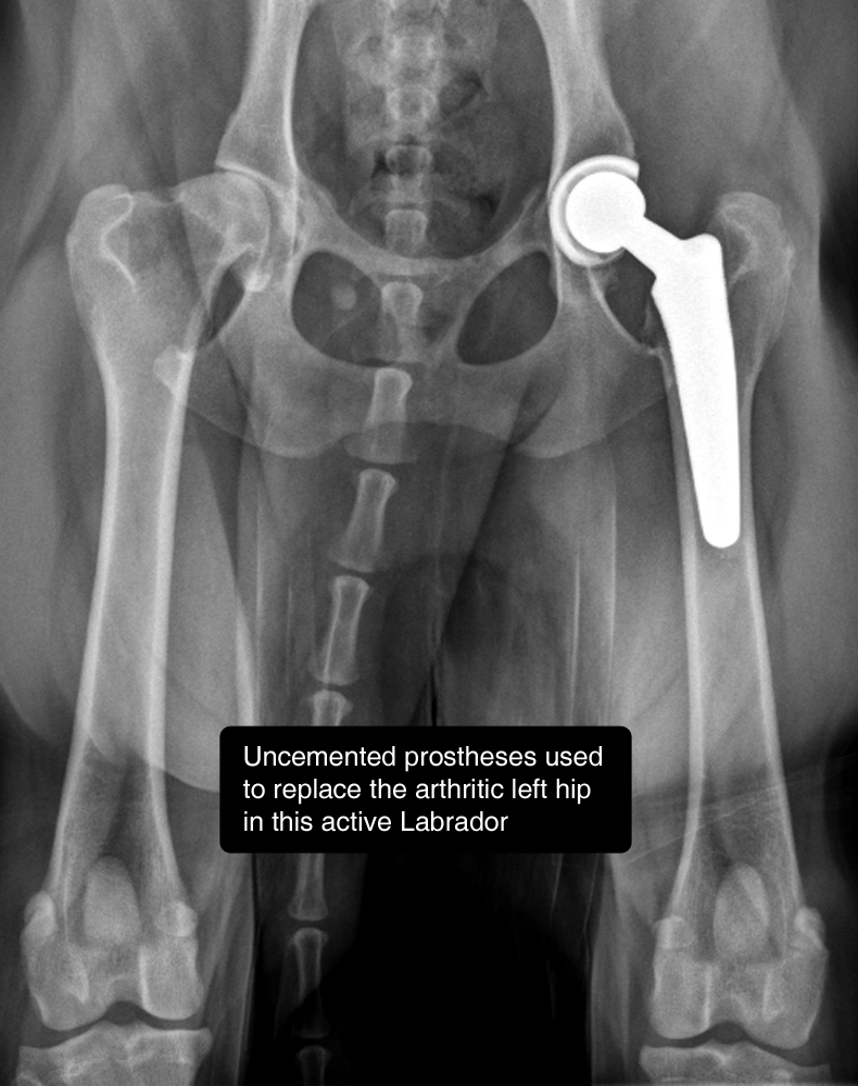 hip dysplasia