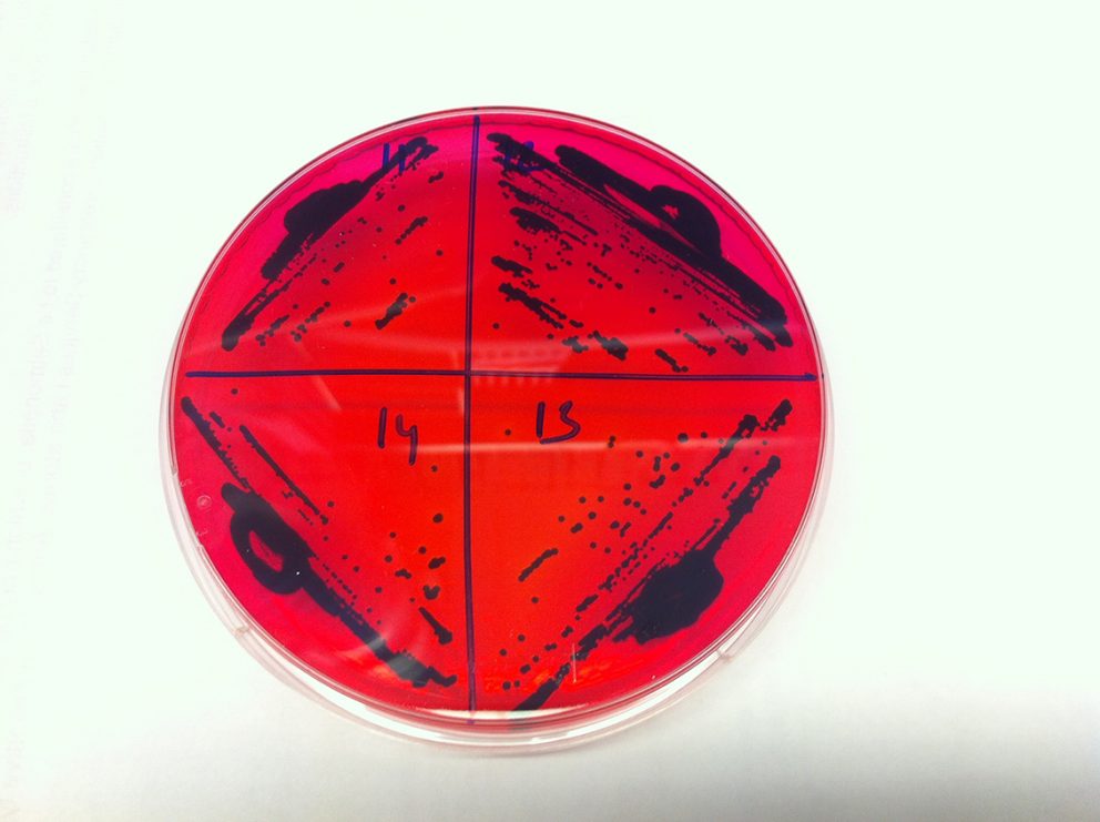 Salmonella sample in petri dish