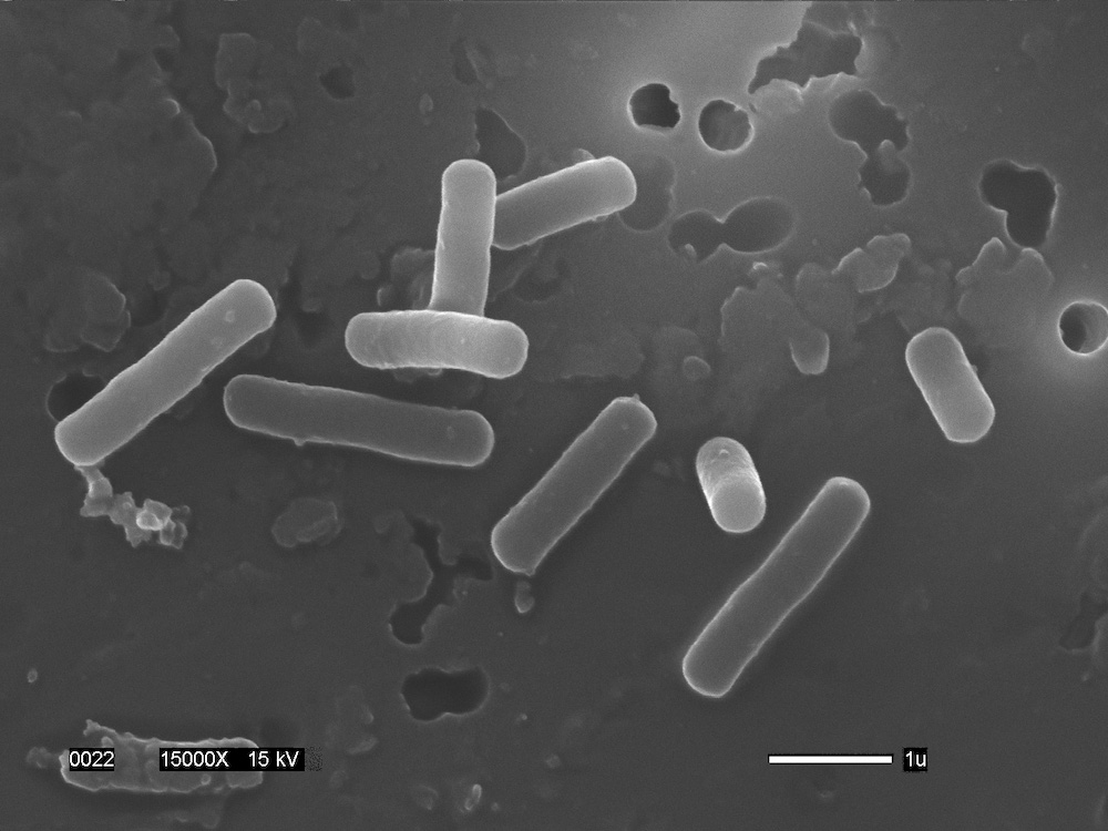 Lactobacillus gasseri electron microscopy.