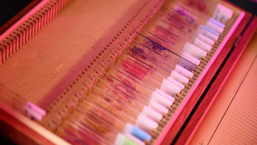 A close-up of a wooden box containing glass pathology slides. The stained cells on the slides show various hues of purples and pinks.