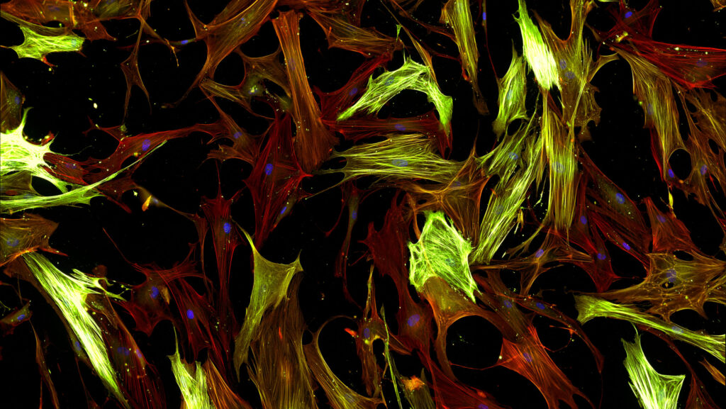 Real fluorescence microscopic view of human cells - human lung fibroblasts